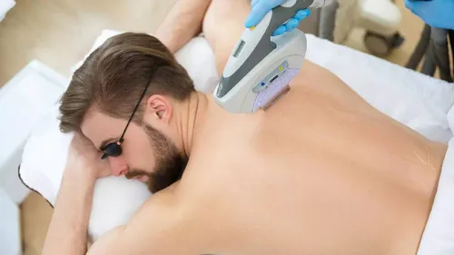 Laser Hair Removal for Ladies & Men at VLCC!